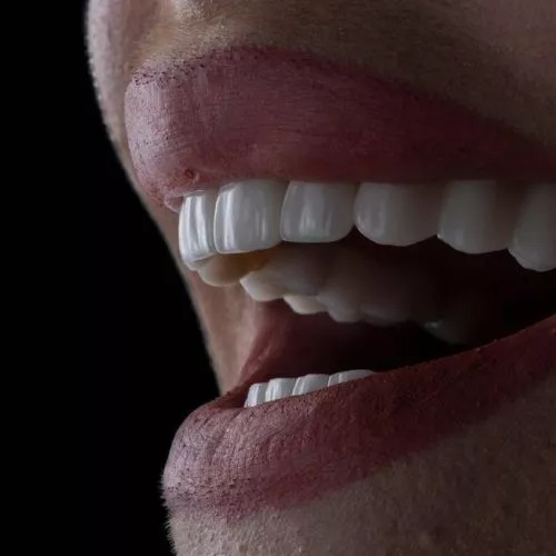 Invisible Braces: The Comfortable Way To Straighten Your Teeth
